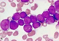 ALL cells