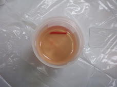 Collected bone marrow aspirate