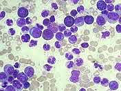 CML cells