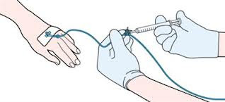 Cannula