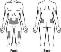 Injection site