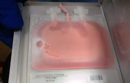 Frozen stem cells