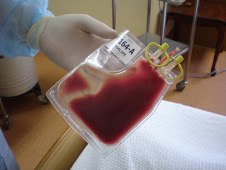 Bag for transplant