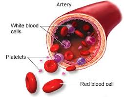 Low platelet / ITP