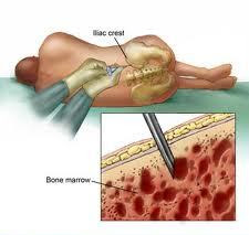 Bone marrow illustration