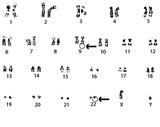 FISH analysis